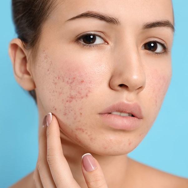 General Dermatology Treatment in Abu Dhabi