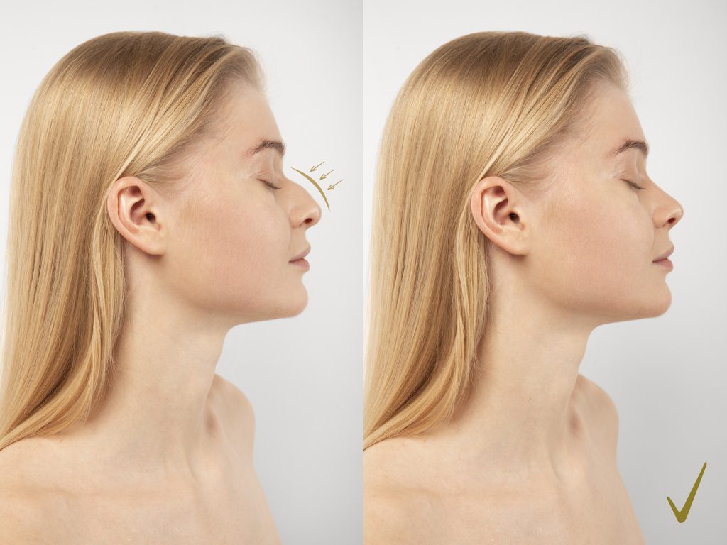 Benefits of Plastic Surgery
