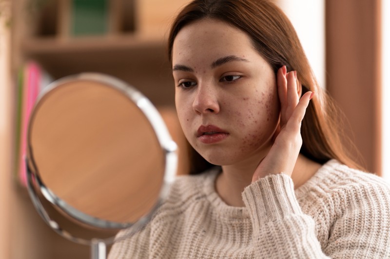 Medical Dermatology Treatments in Abu Dhabi