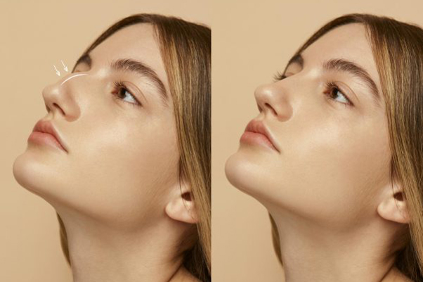 plastic surgeon in Dubai